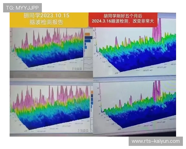 脑波监测技术探索情绪反馈 优化观赛内容制作